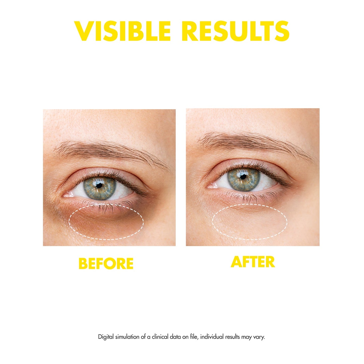 OOTD Dark Circle Eye Serum (VC+)