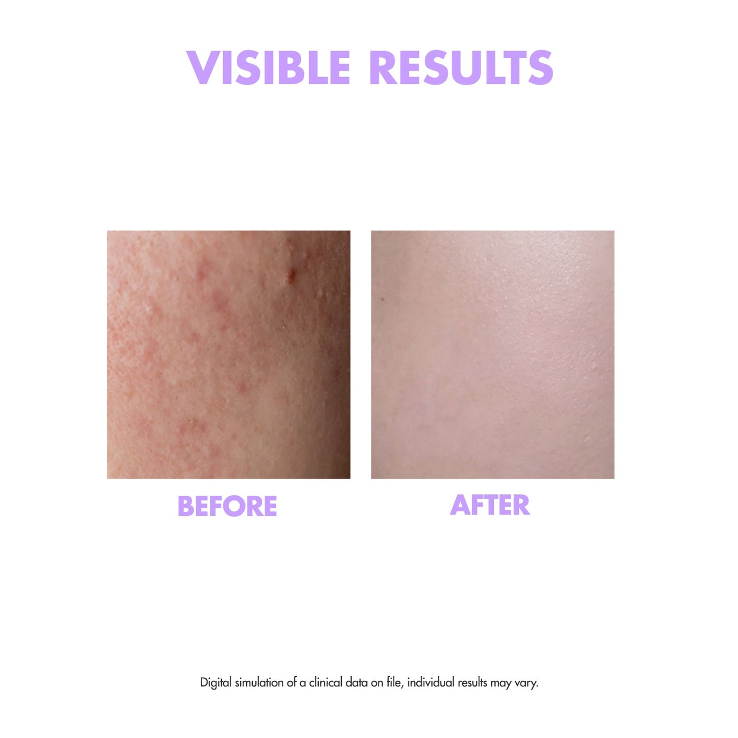 OOTD Overnight Exfoliating Face Serum P.M (P+)