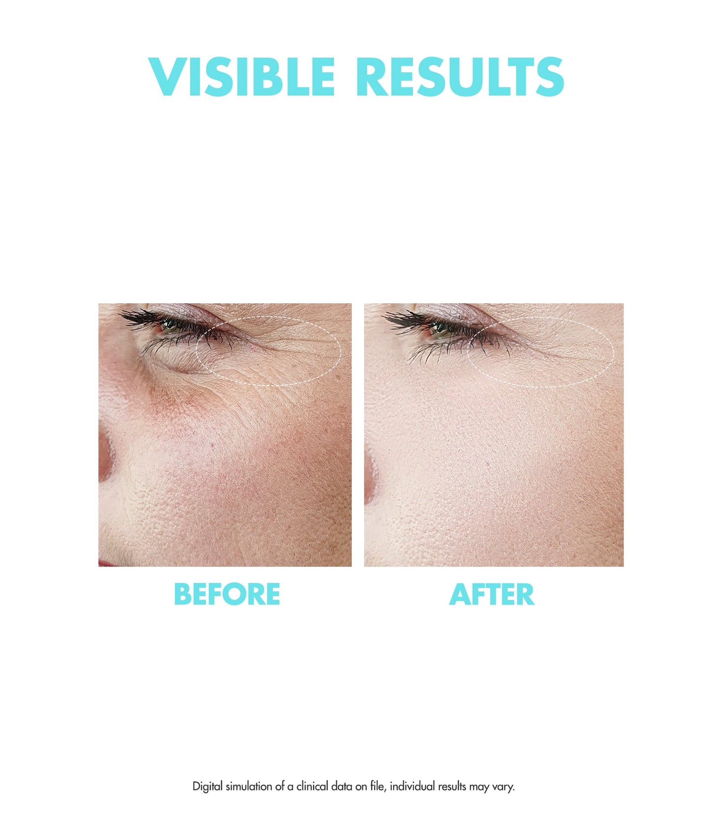 OOTD Retinol Rookie Set