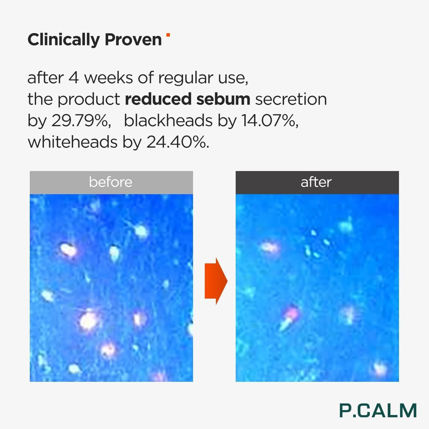 P.Calm Barrier Cycle Toner
